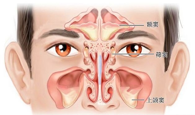 单侧鼻塞是怎么回事 鼻疾病 疾病介绍 就诊指南