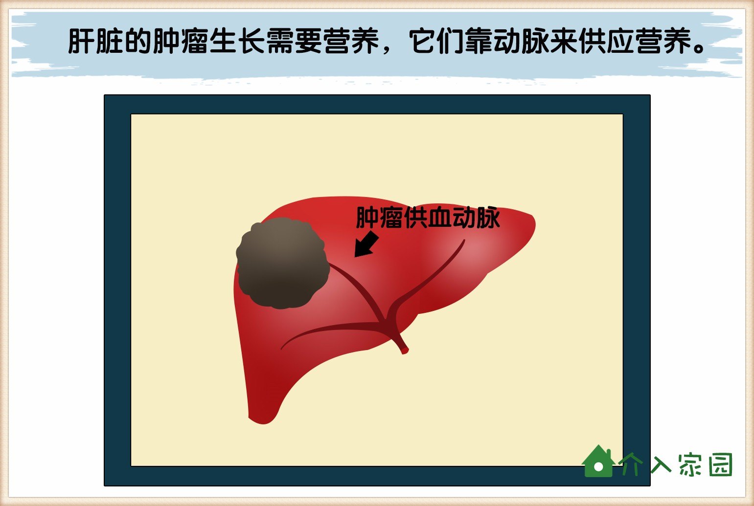 擅长：肿瘤介入治疗：肝癌的超分割放射治疗、经皮穿刺微波凝固治疗、射频治疗；食管癌外照射与近...号贩子挂号电话_挂号无需排队，直接找我们的简单介绍