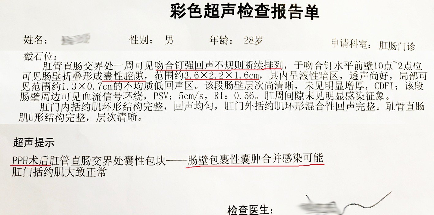 痔疮微创致肠脓肿1例 - 好大夫在线