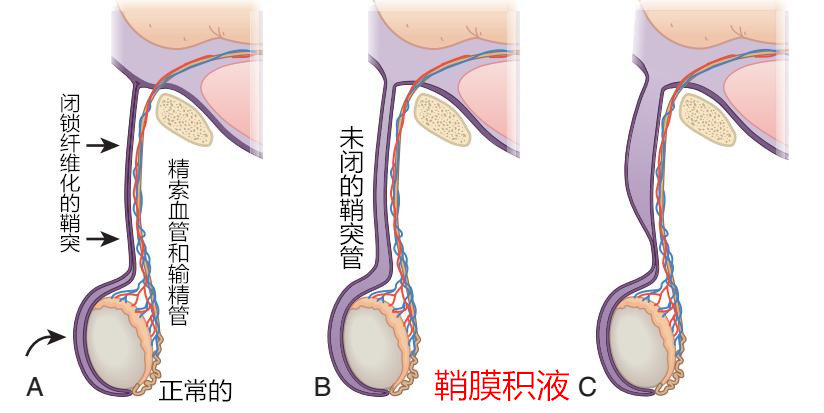鞘膜解剖图图片