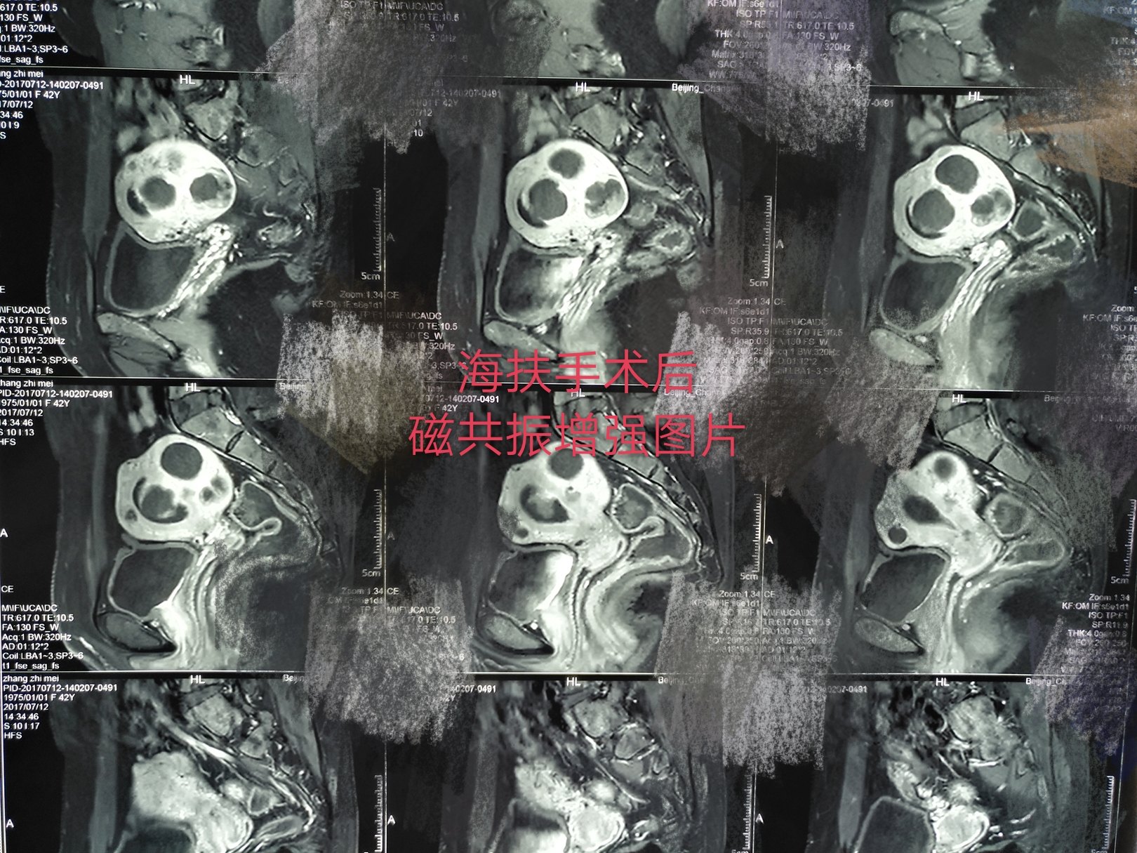 暂无