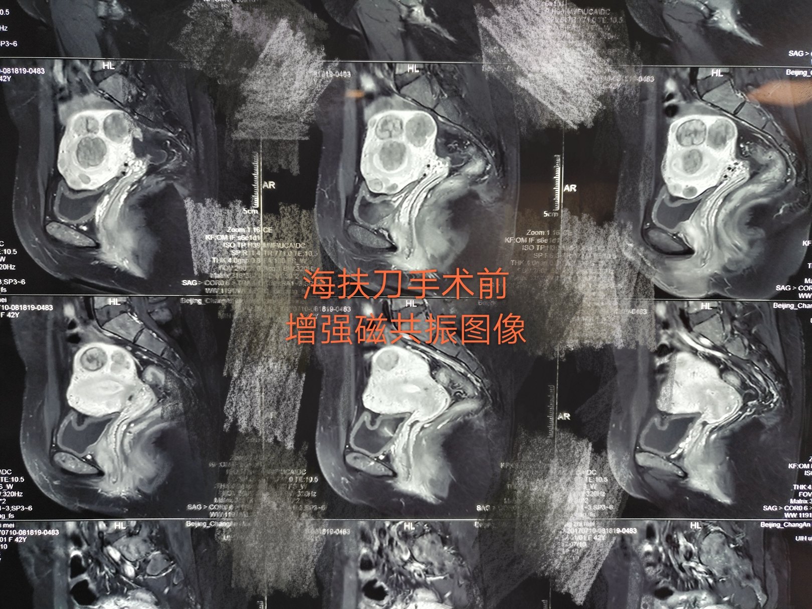 暂无