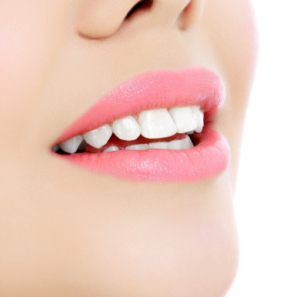 牙齿美容:牙齿矫正器的种类有哪些? - 好大夫在