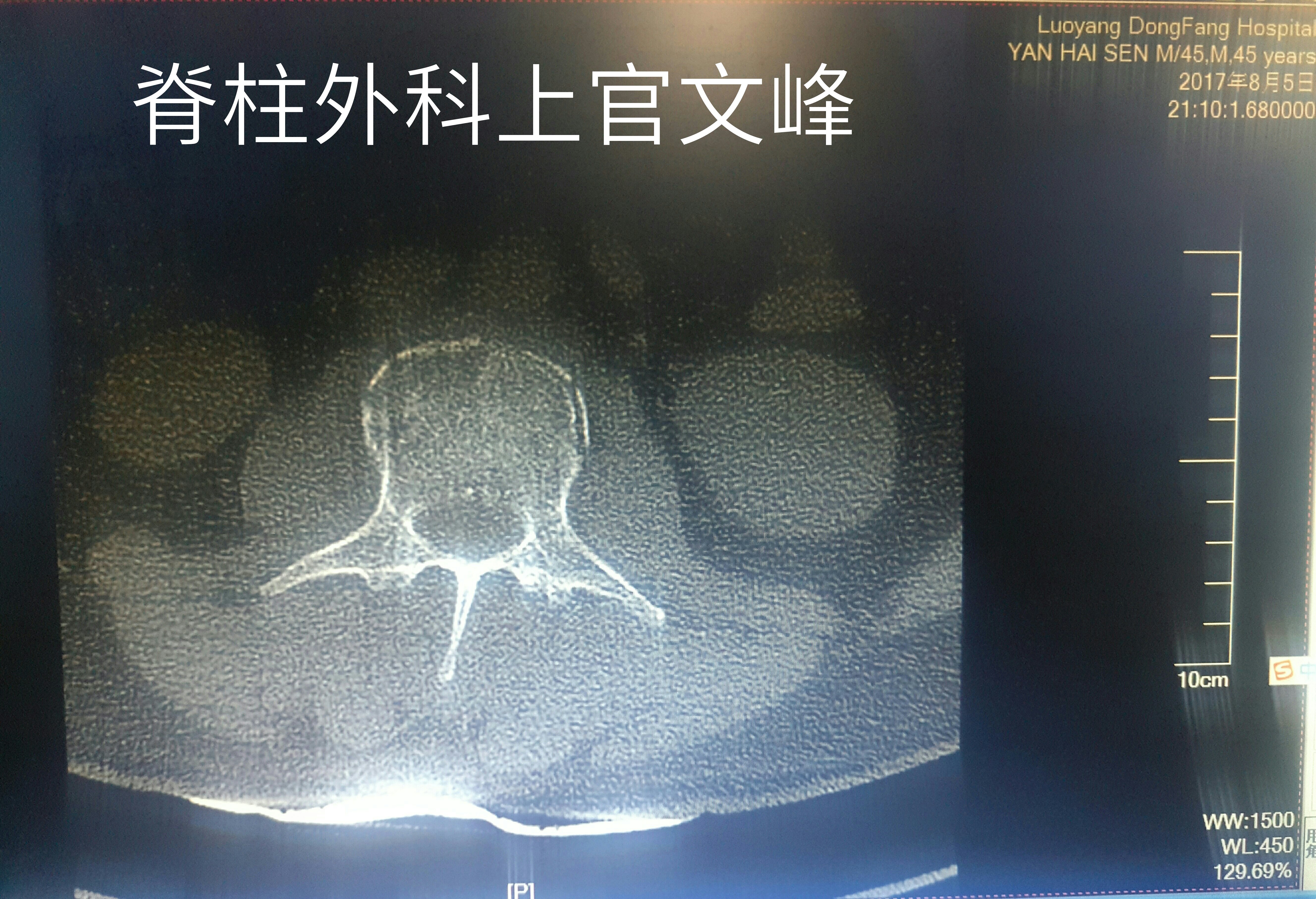 暂无