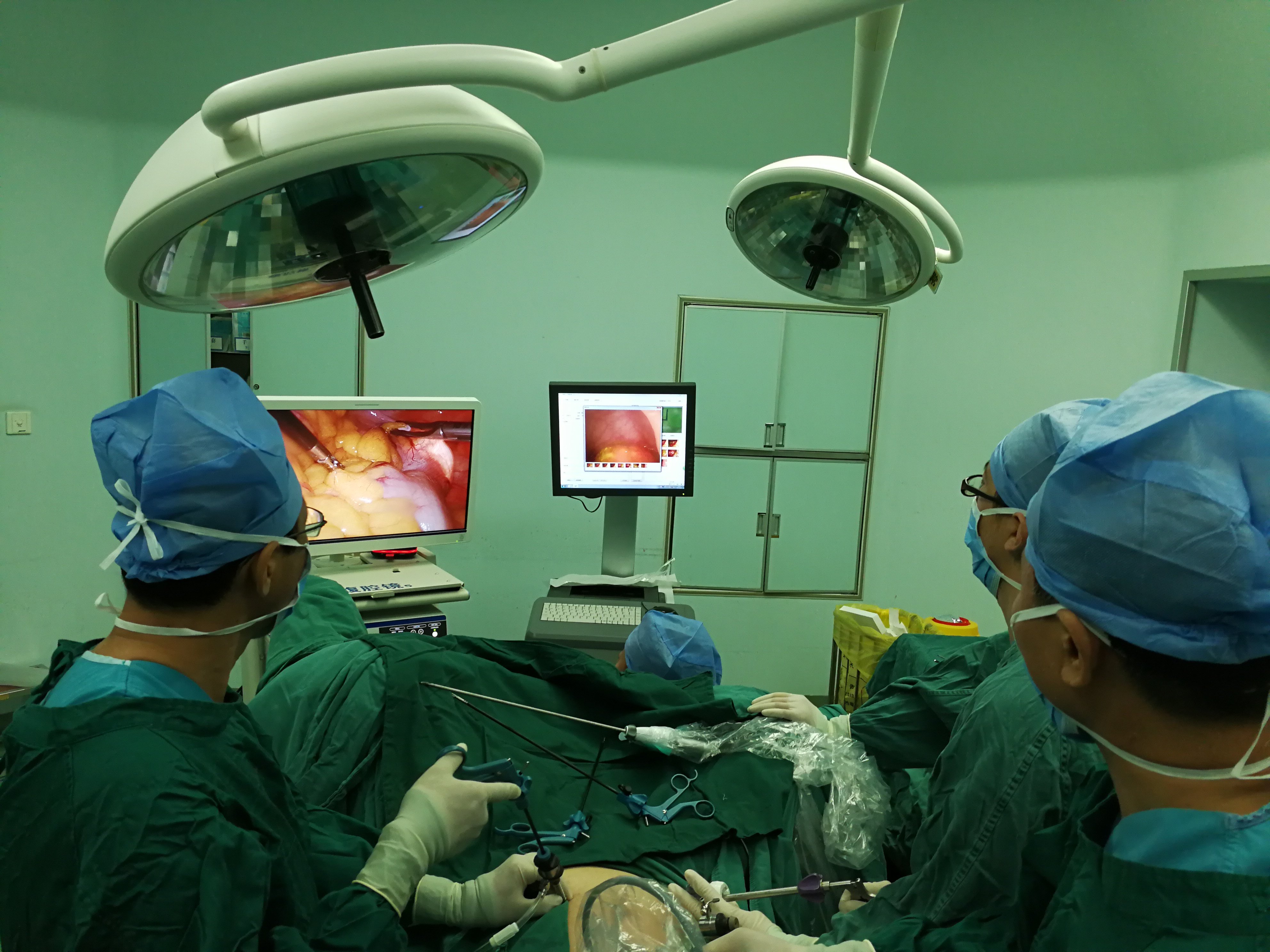 双镜联合腹腔镜直肠癌手术——肛肠科刘桂伟副主任医师 