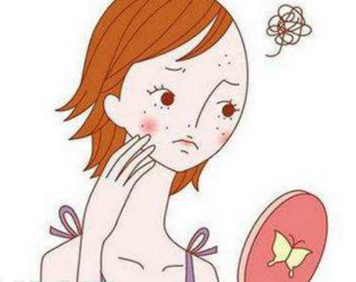 什么是痤疮?长了痤疮怎么办?