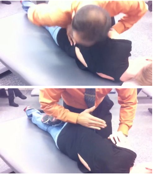 美式整脊之骨盆矫正