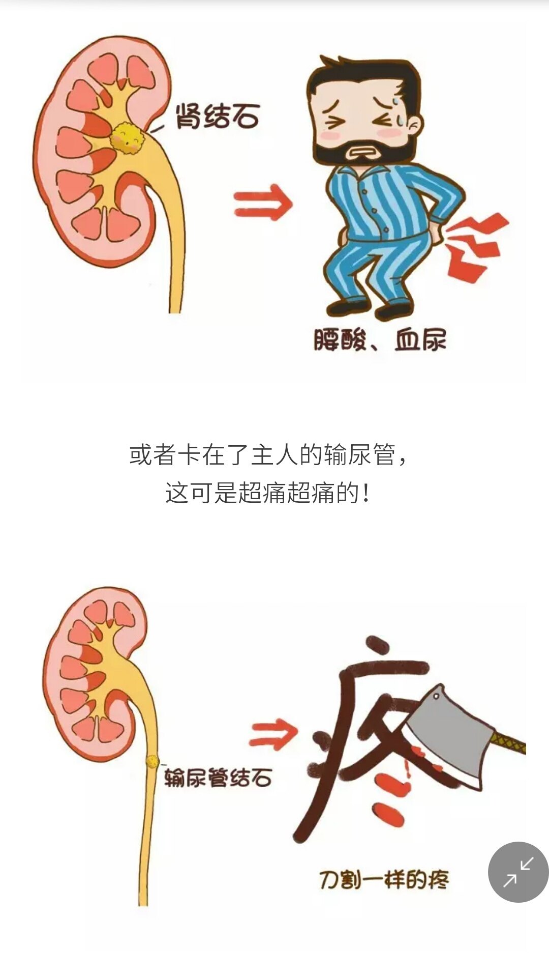 输尿管结石卡通图片图片