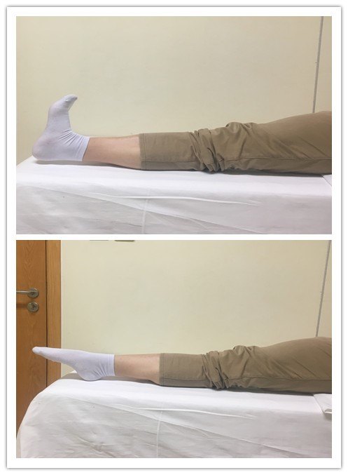 微创全膝关节表面成形术后康复锻炼指导