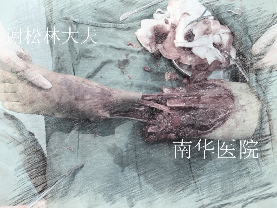 前两年发生一场莫名其妙的车祸,一帮人在小区悠闲的晒太阳打麻将