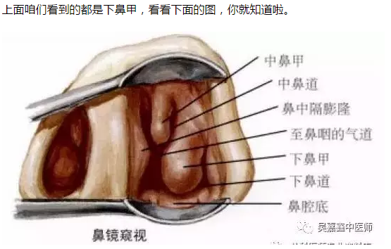 鼻炎和正常鼻子图解图片