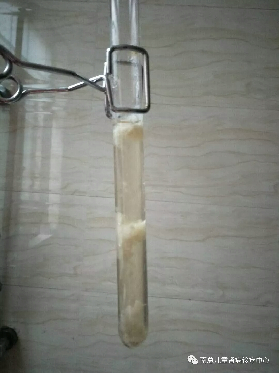 最快捷!观察尿中是否有蛋白的方法 - 好大夫在线