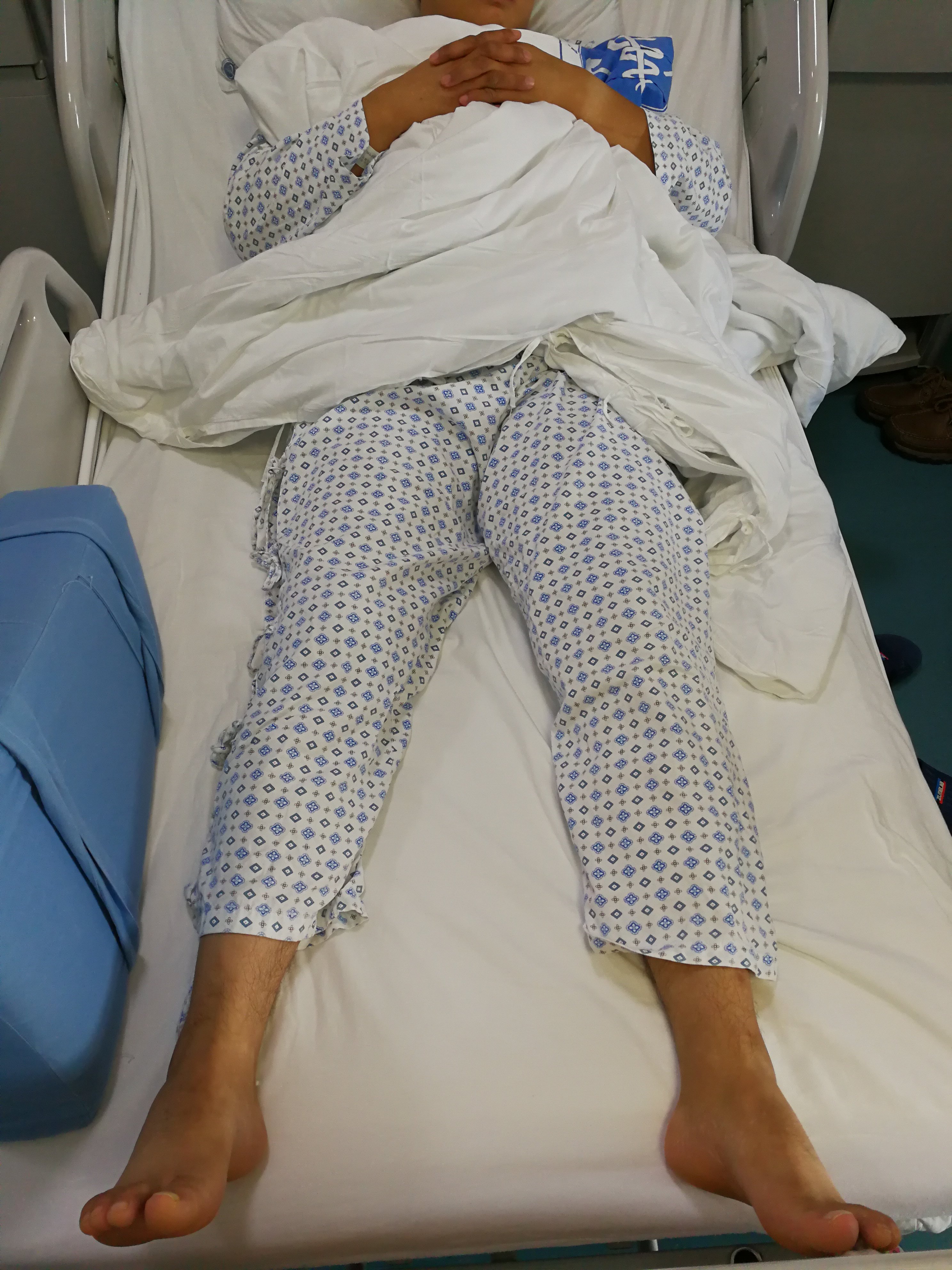 严重股骨头缺血性坏死肢体短缩的手术治疗