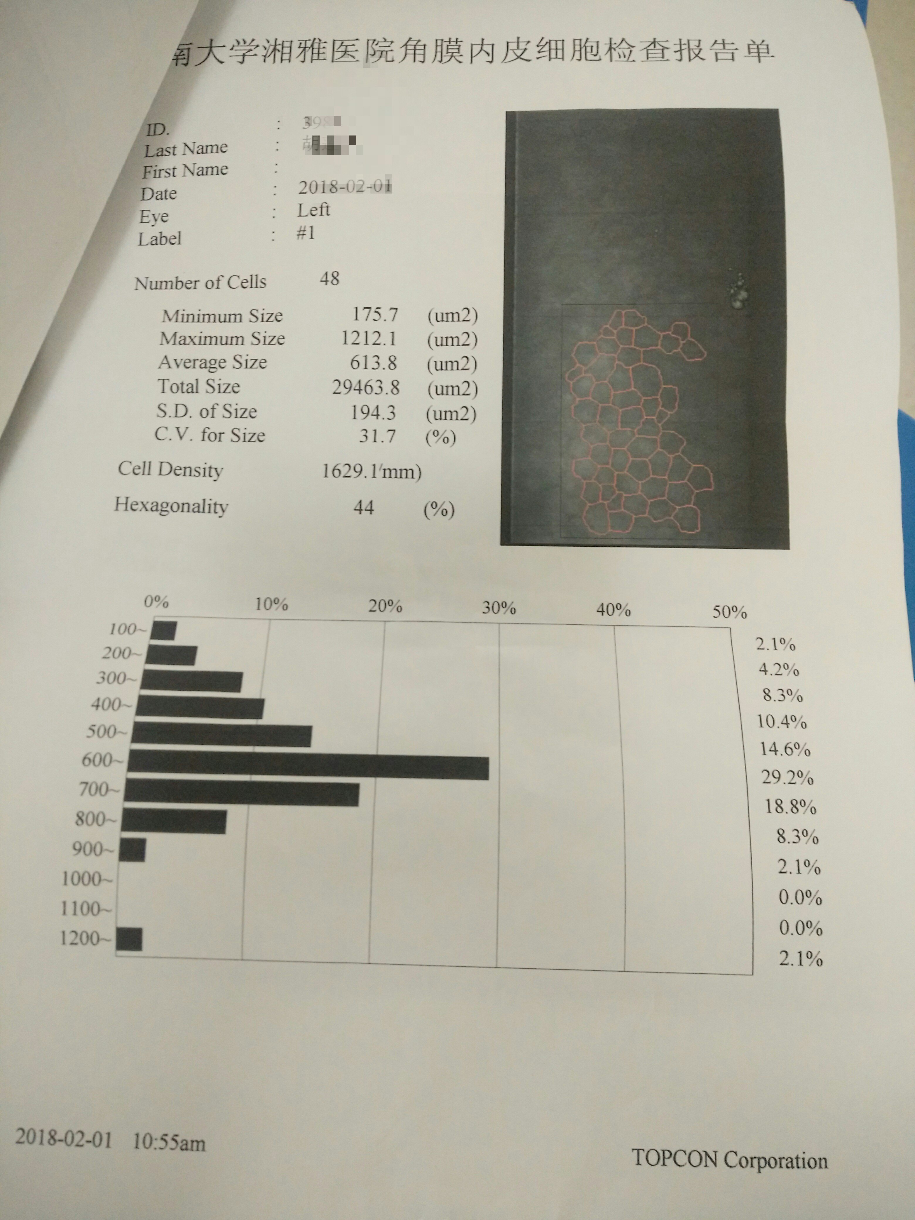 双眼ubm.右眼视神经oct分析.双眼视网膜黄斑部oct.