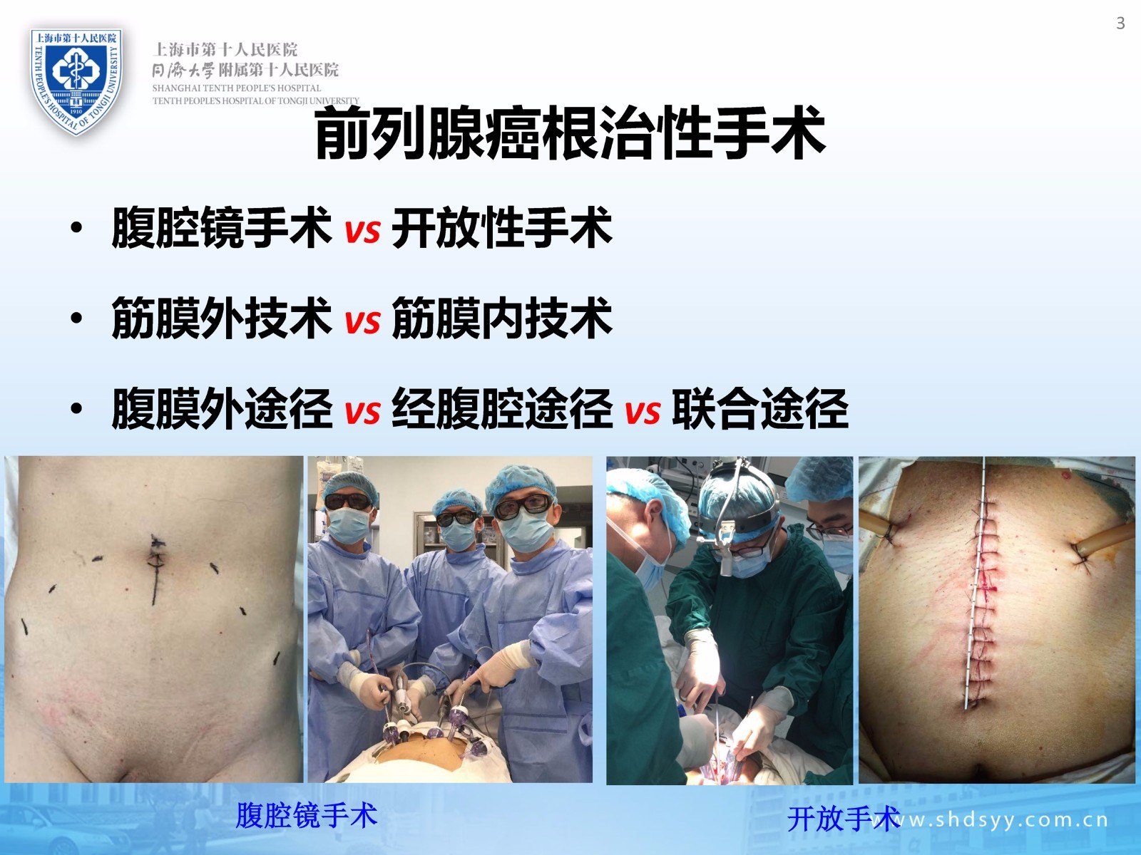 前列腺癌诊治:2017年工作总结以及2018年工作