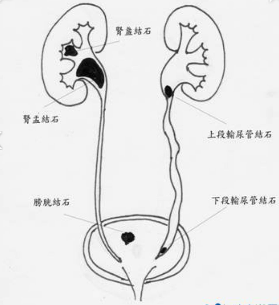 泌尿系统简图手绘图片