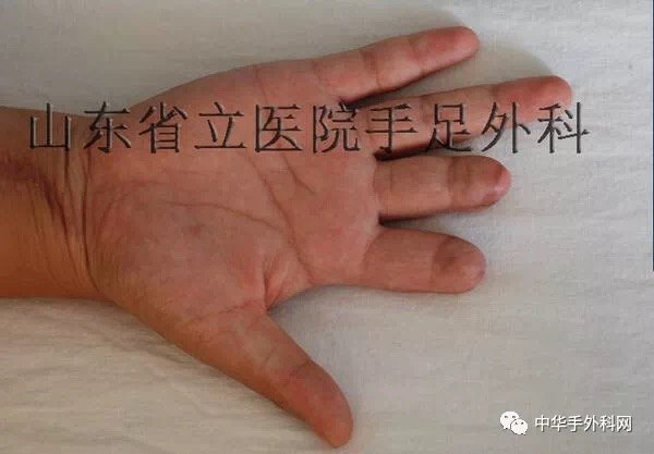 王增涛教授再造作品