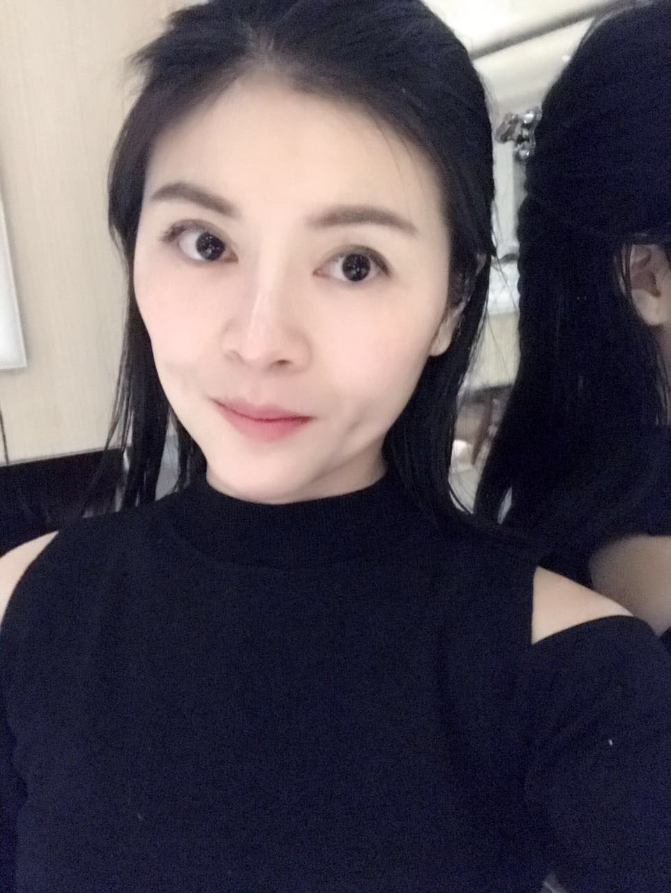 鼻部假体置换隆下颌面部微创提升,酒窝成形的