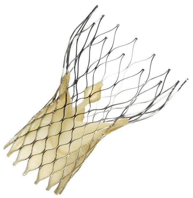 经导管主动脉瓣置换术(tavr)——瓣膜病治疗新技术的亮