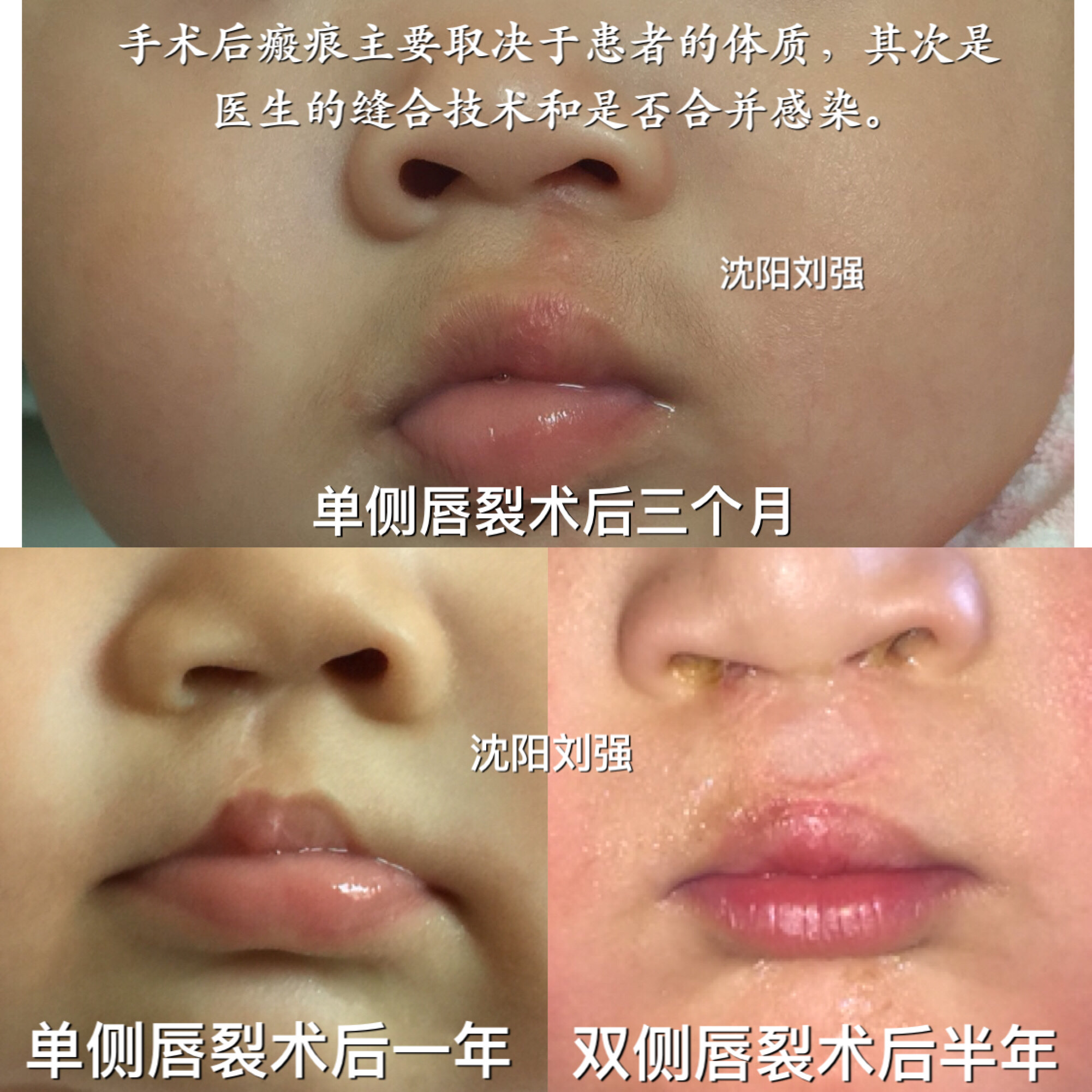 暂无