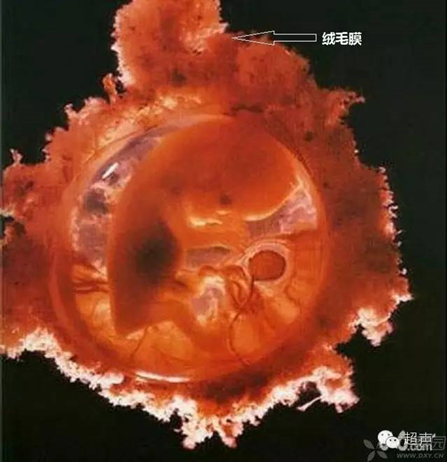 蜕膜管型图片大全图片