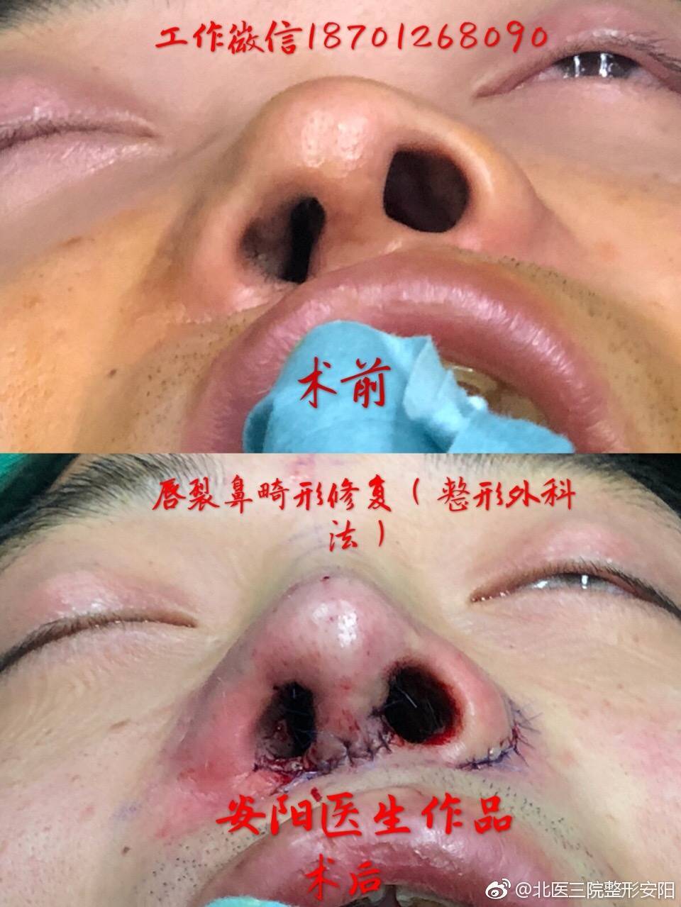 暂无