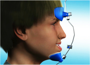 尹星博士谈唇腭裂正畸-序列治疗的正畸内容 - 好大夫在线