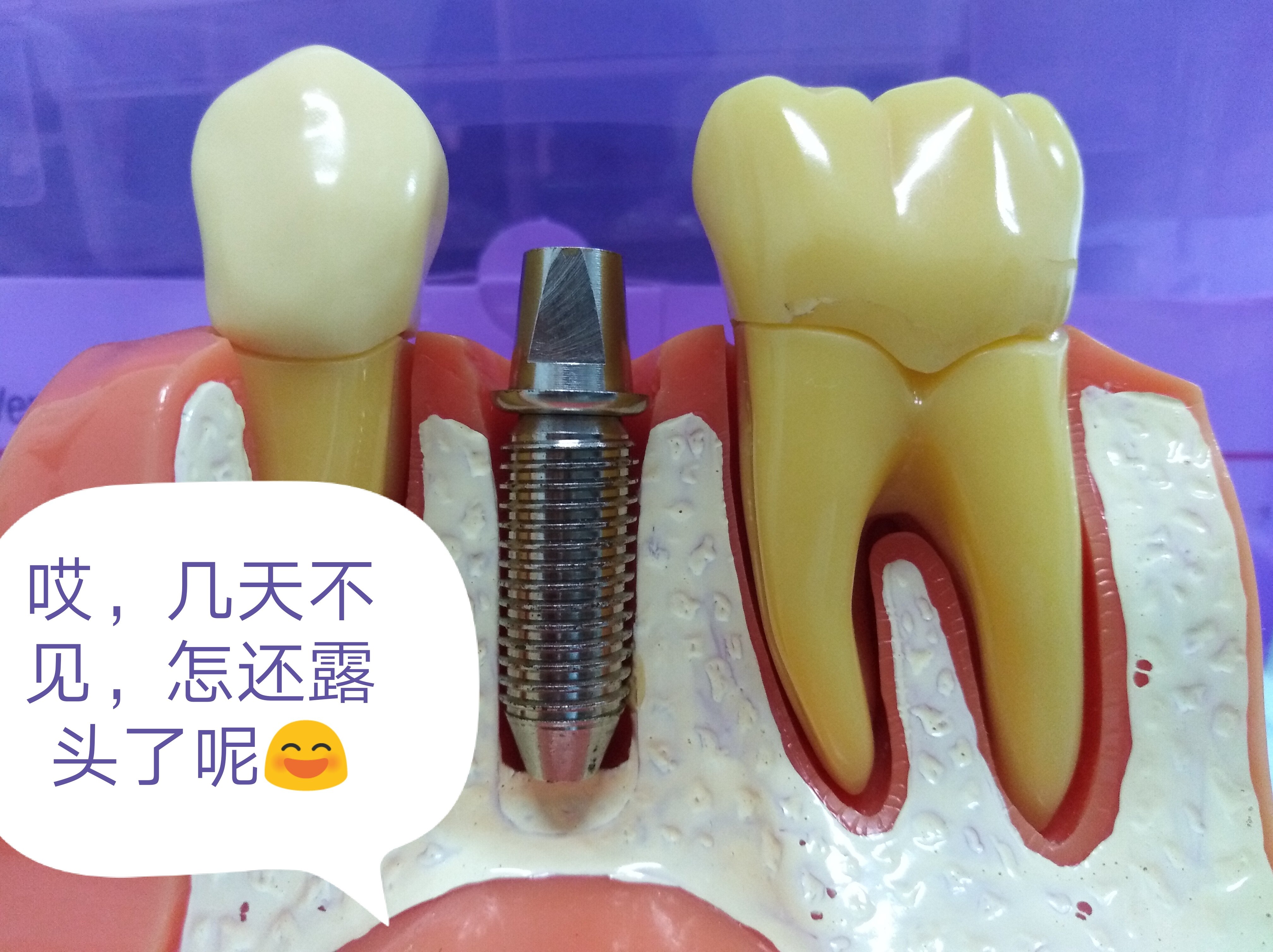 林宝山医生关于种植牙的对话_牙齿种植_牙齿种植疾病介绍 好大夫