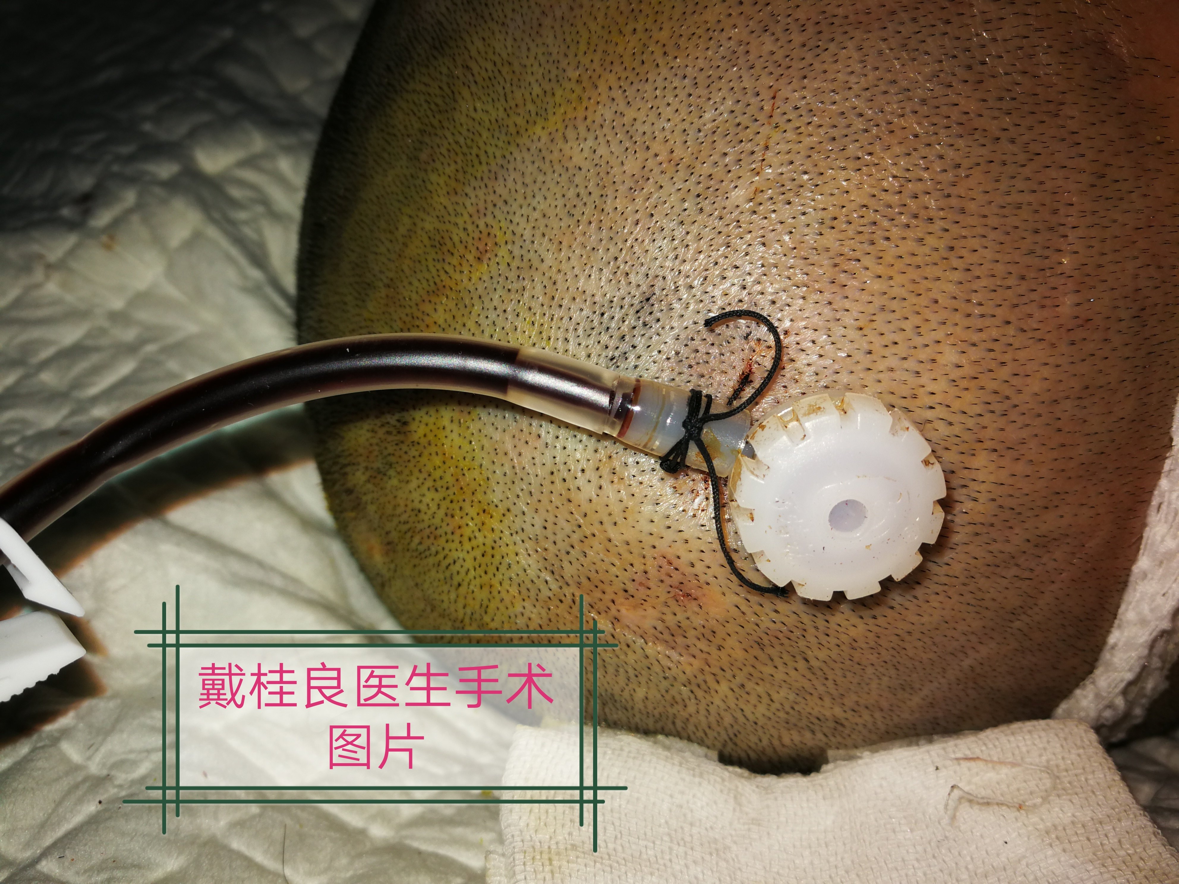 暂无