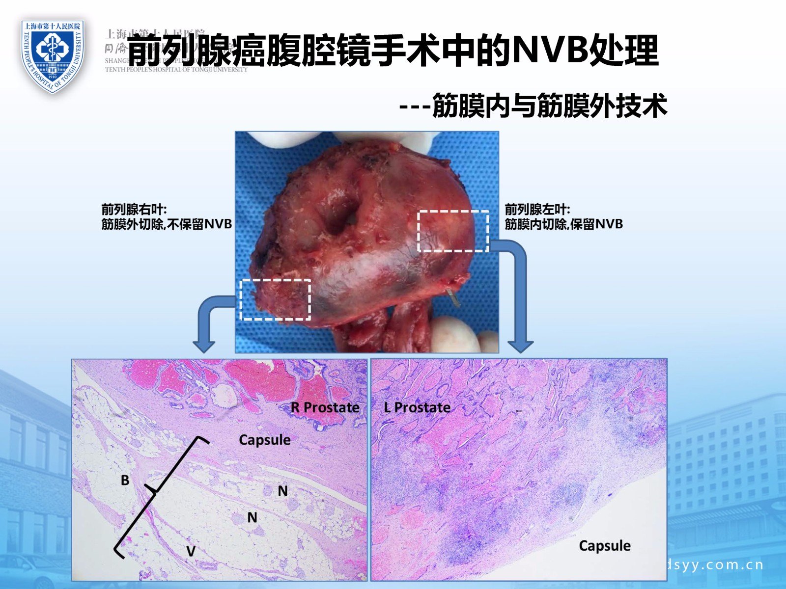 前列腺癌诊治:2017年工作总结以及2018年工作