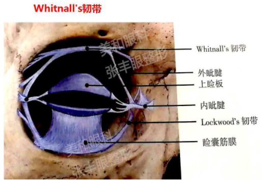 眼部内眦韧带图图片