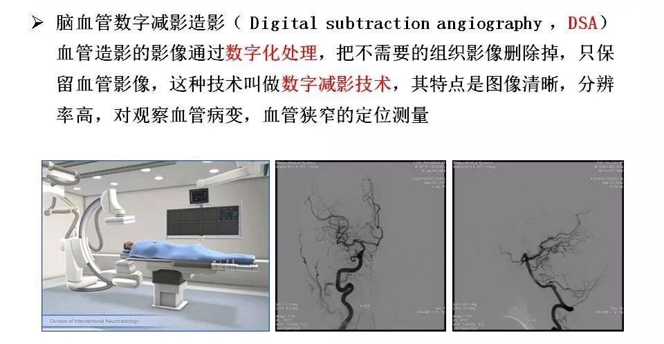 什么是dsa ? - 好大夫在线