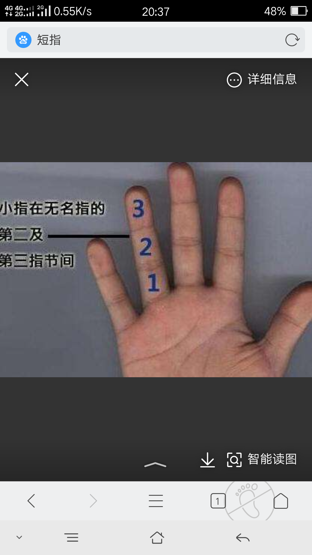 marchesani综合征
