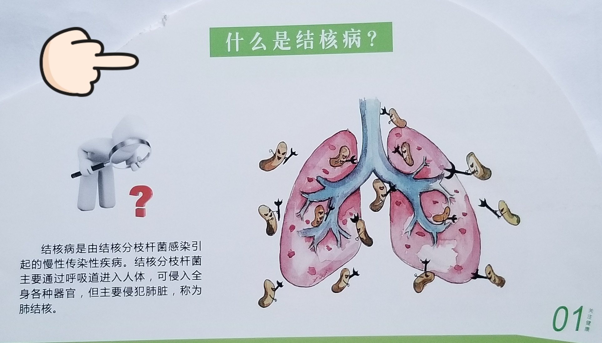 什么是肺结核什么是耐药结核病结核病的传染源,它是如何传播的?