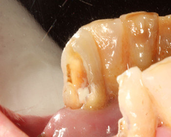 尽量保留自己的残冠一例 - 好大夫在线