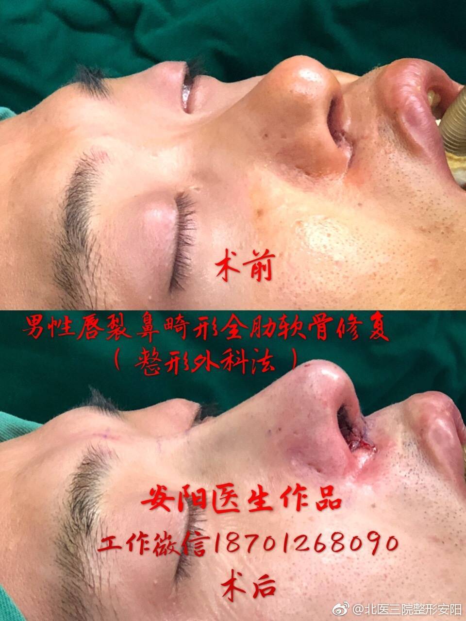 暂无