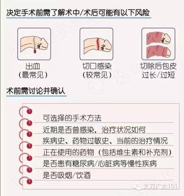 麻醉的選擇: 兒童:基礎麻醉 局部麻醉,需住院手術 青少年或成人:局部