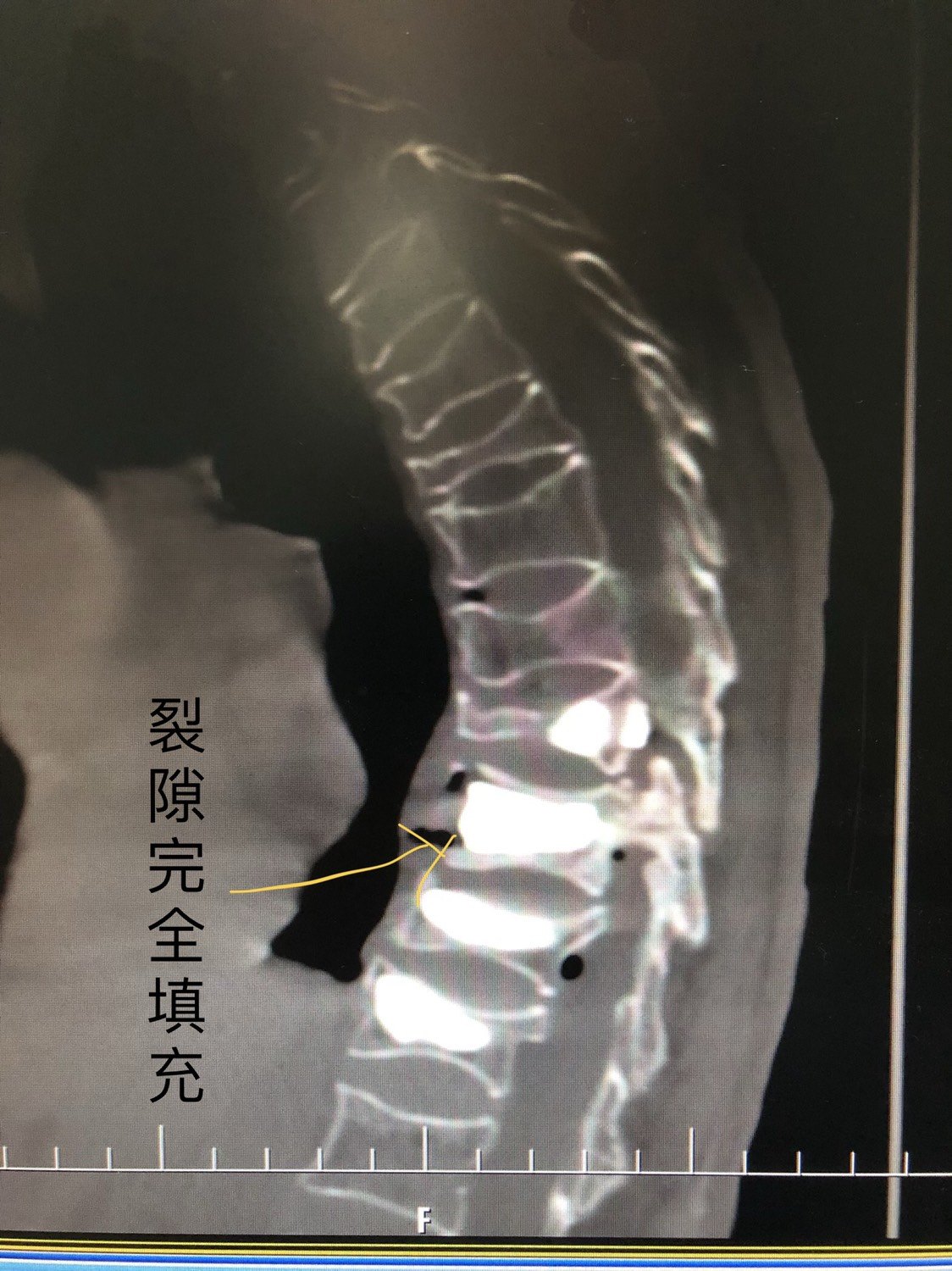 暂无