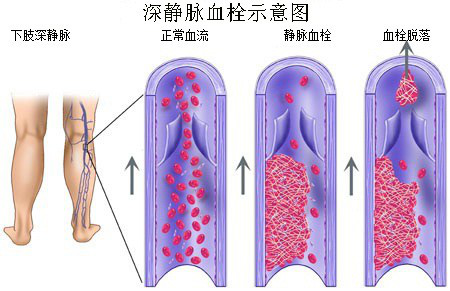 1531722202873775.png 浅静脉.png