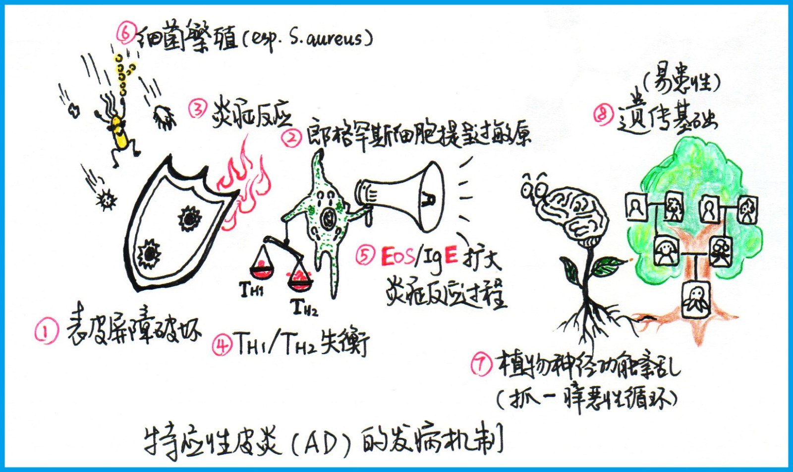 表皮屏障的破坏:2朗格罕斯细胞提呈过敏原3炎症反应4