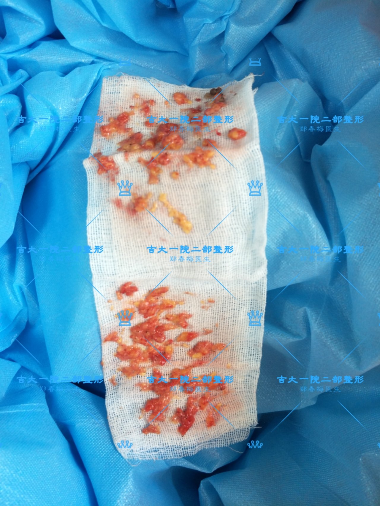 腋臭 狐臭 好大夫在线 腋臭 狐臭 好大夫在线