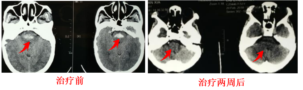 1527828644600343.png blob.png