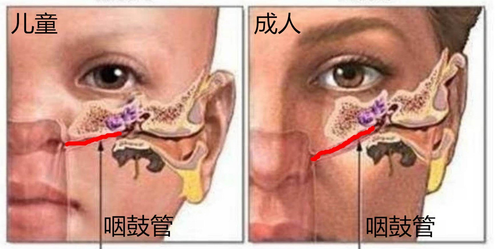 耳朵捏着痛反映身体图片