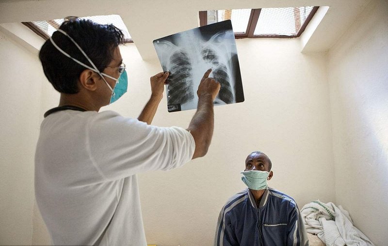 肺结核到底有多恐怖,即使完全消灭结核菌,也不能治回完好的_肺结核