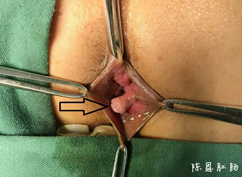 1525700421893503.png 图片2.png