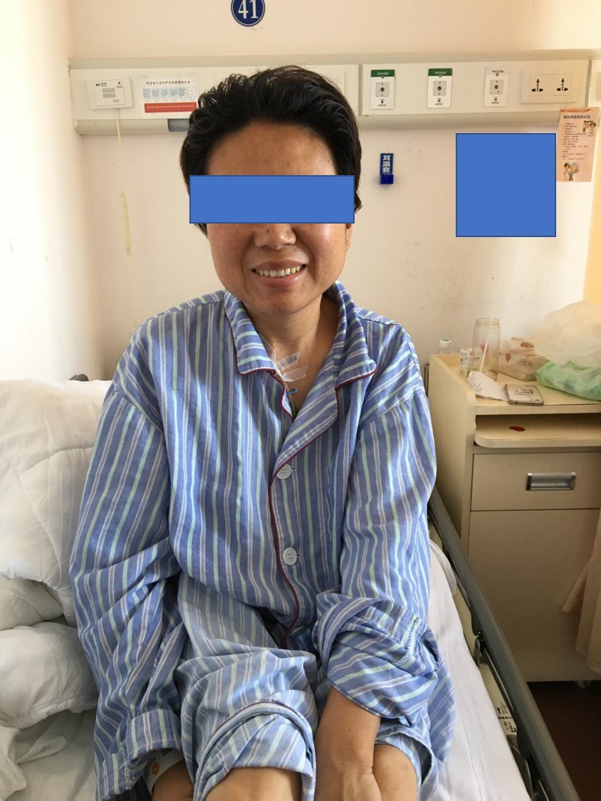 经鼻微创手术治疗泌乳素型垂体瘤