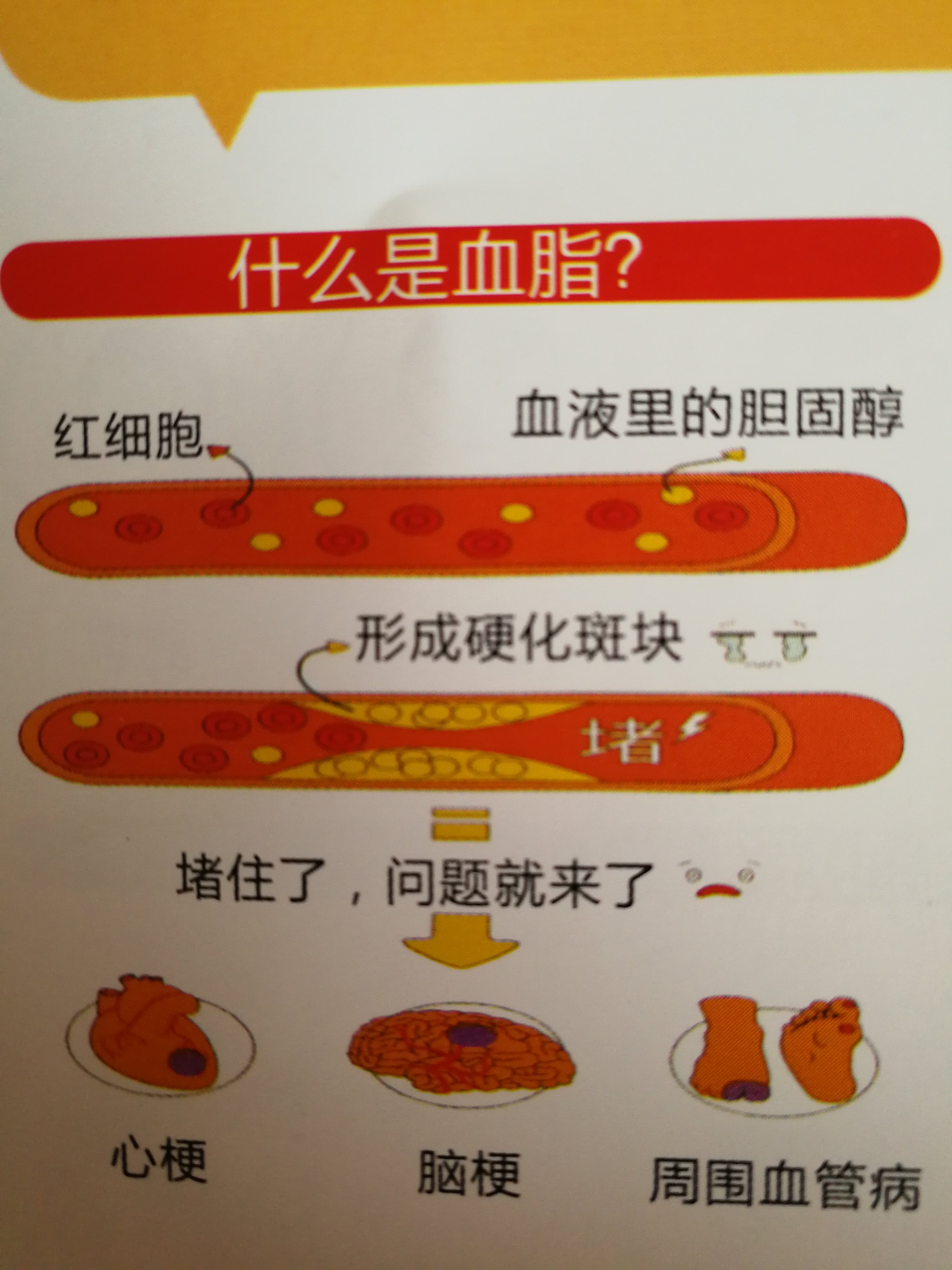 高脂血症科普 - 好大夫在线