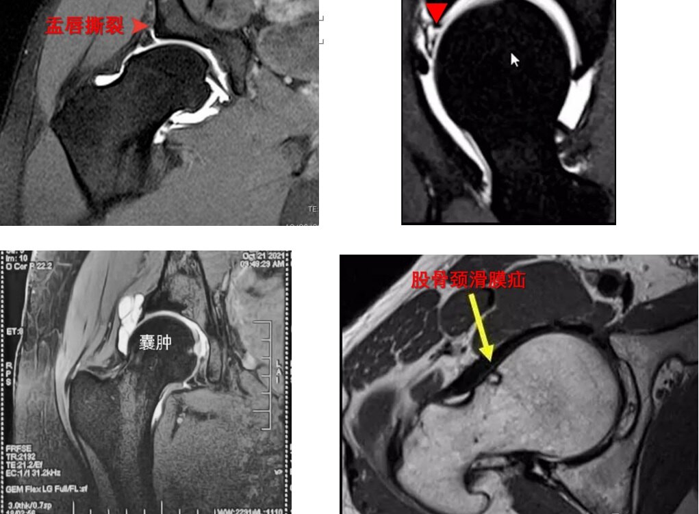 MRI.jpg