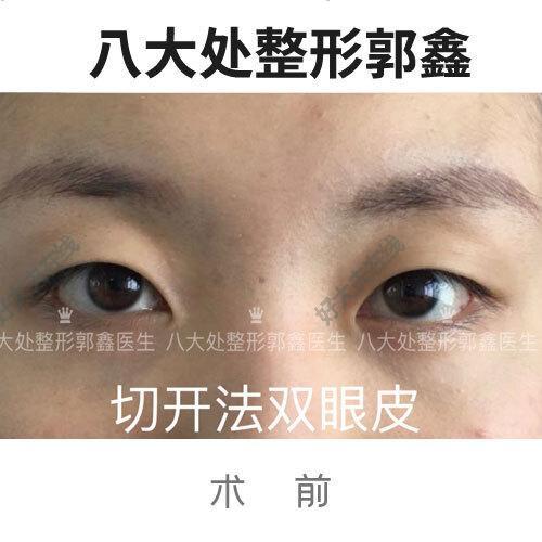圖文圖片