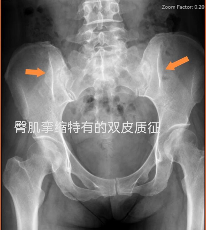 圖文圖片